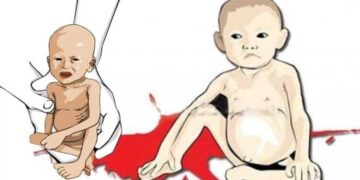 Dua Pasien Gizi Buruk Sedang Dirawat di RSUD Bula